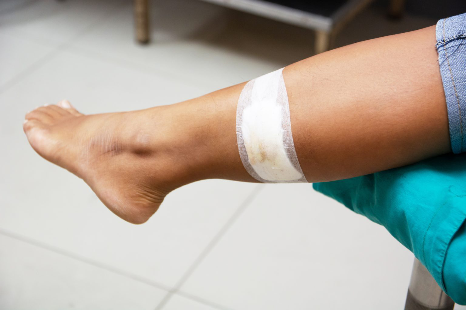 Lower limb wounds and chronic ulcers affecting legs, ankles, and feet