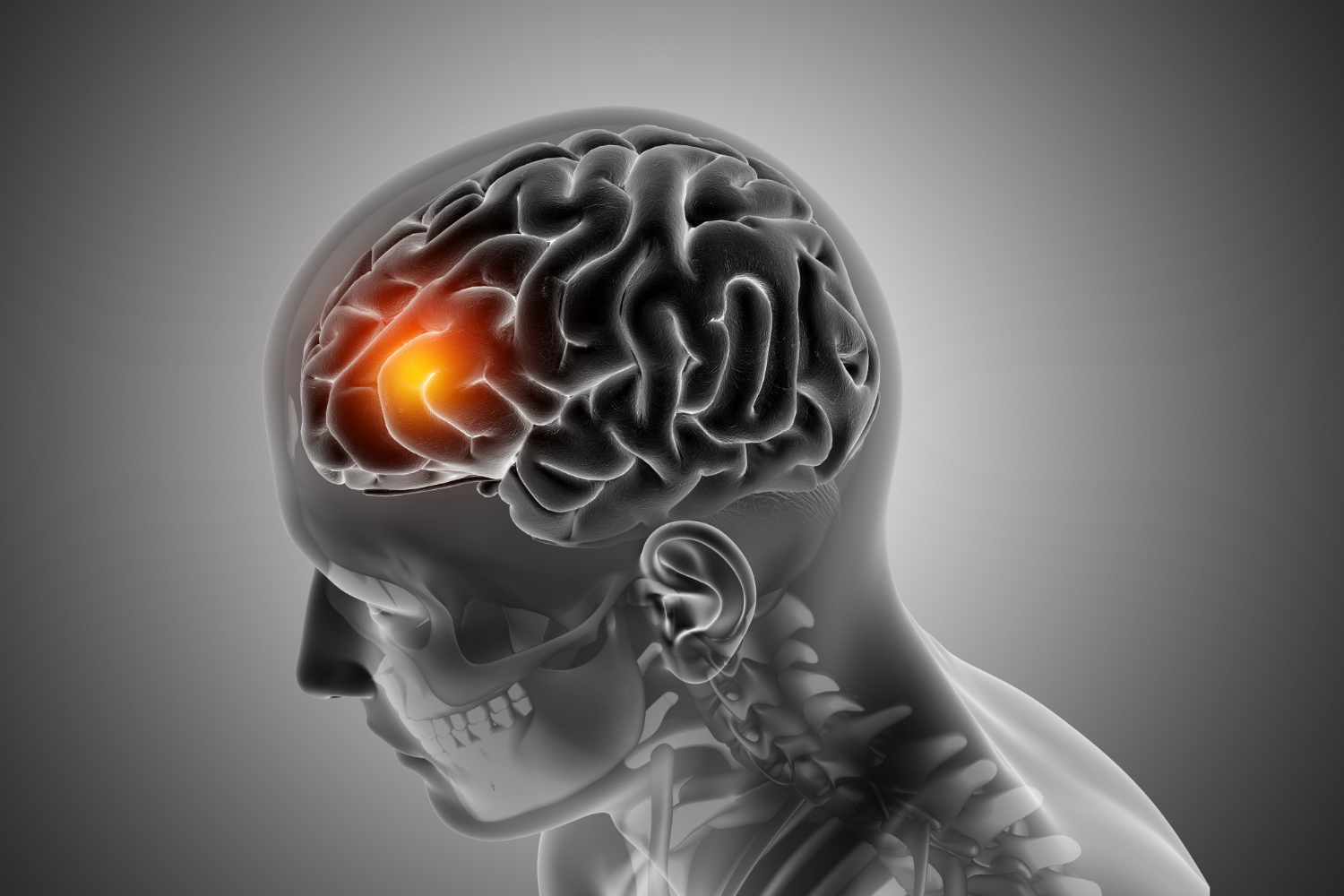 Neurological pain from nerve damage or dysfunction affecting localized or widespread areas
